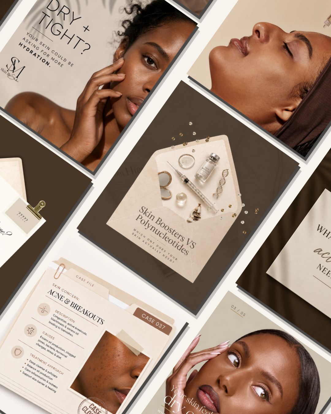 Collage of Skin By Shukri Instagram posts including Skin Boosters vs Polynucleotides and an acne and breakouts case file